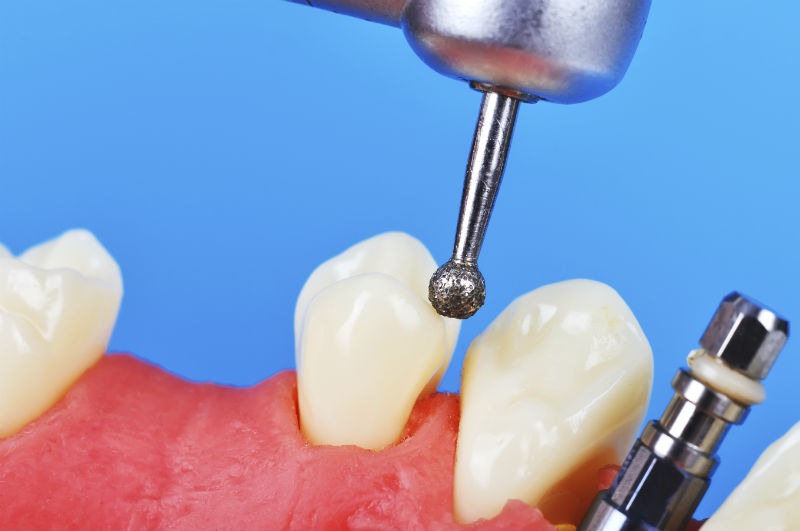 Prosthodontistry: Here's What You Should Know